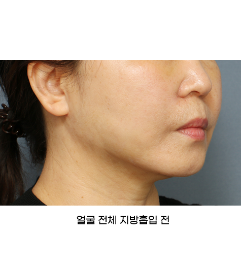 Before 10 45 Degrees