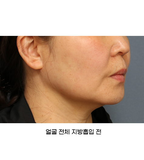 Before 10 45 Degrees