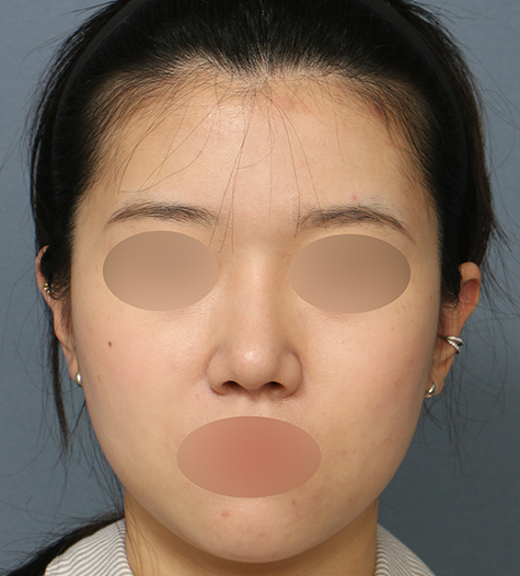 Before 9 Front