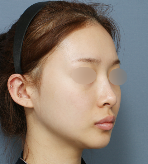 Before 11 45 Degrees