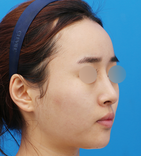 Before 12 45 Degrees