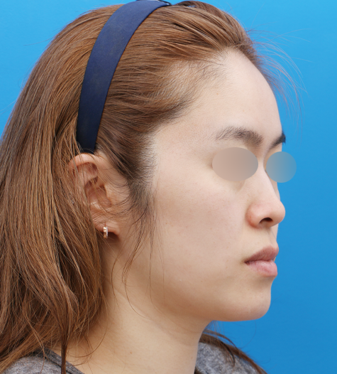 Before 10 45 Degrees