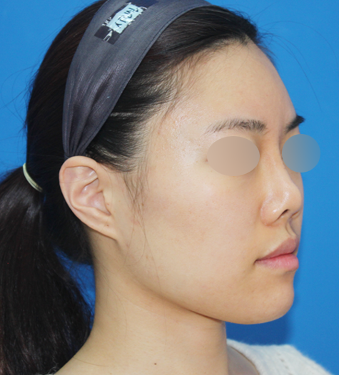 Before 11 45 Degrees