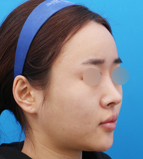 Before 12 45 Degrees