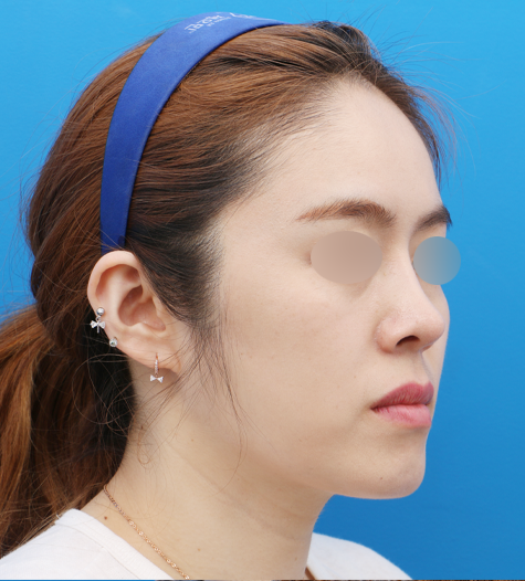 Before 10 45 Degrees