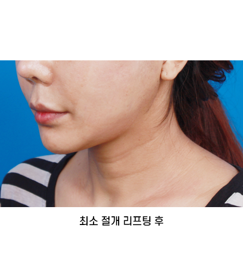 Before 11 45 Degrees