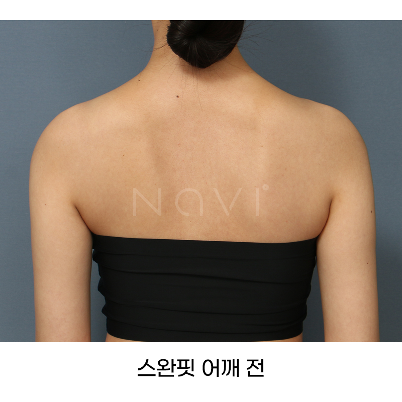 Before 7 Front