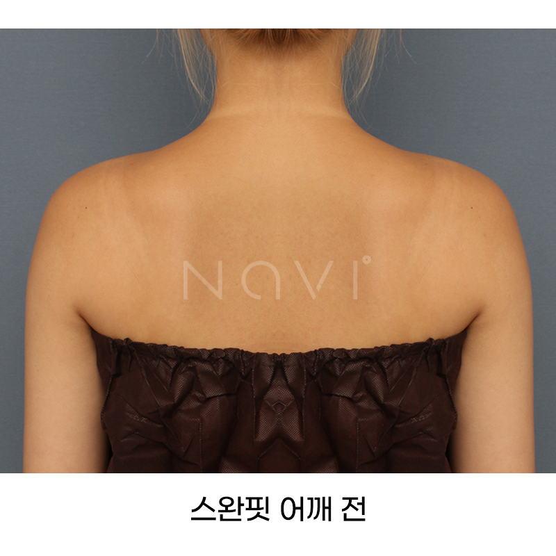 Before 7 Front