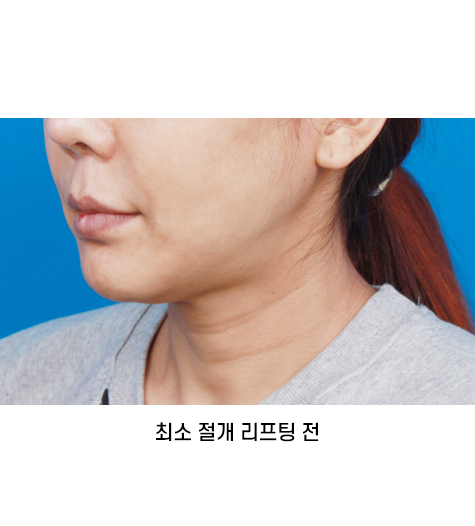 Before 11 45 Degrees