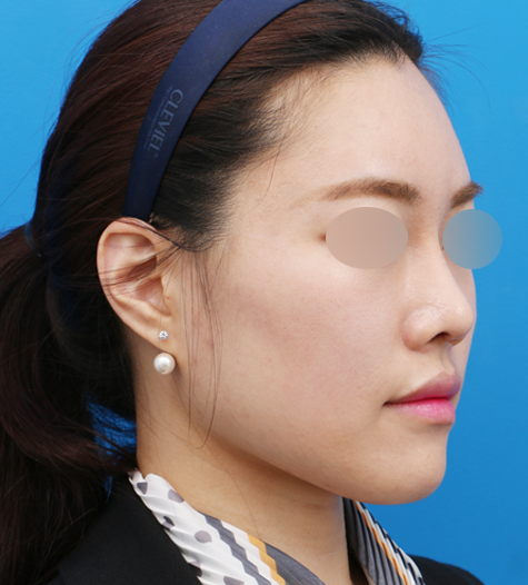 Before 11 45 Degrees