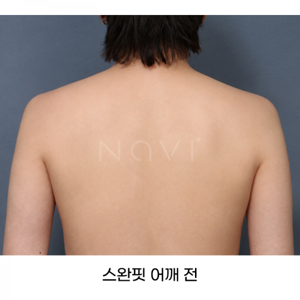 스완핏 어깨